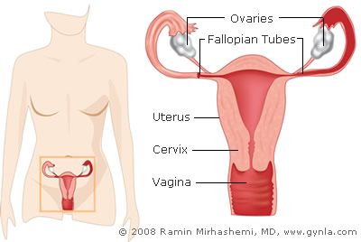 Hysterectomy